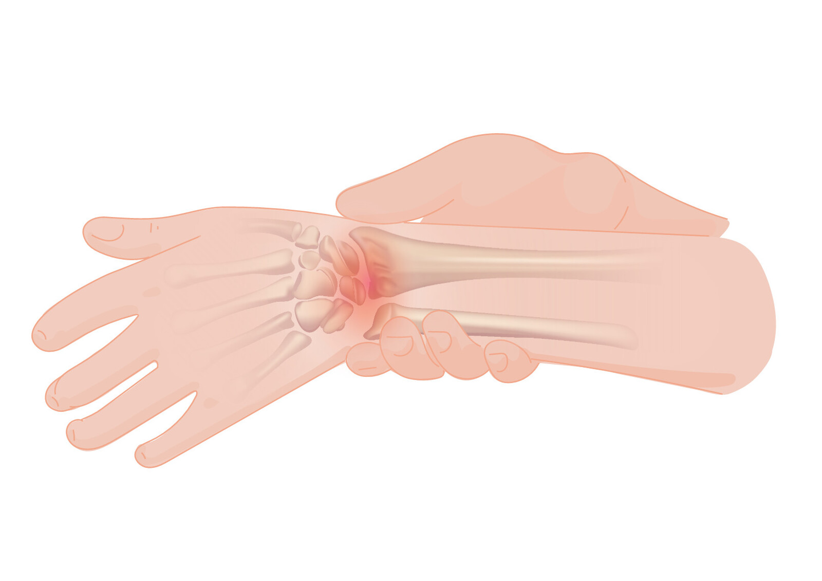 The Pain Gap: Why Women's Pain Is Undertreated and Overlooked in Medicine
